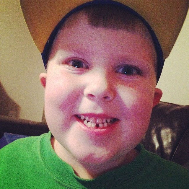 Gavin lost his 1st tooth